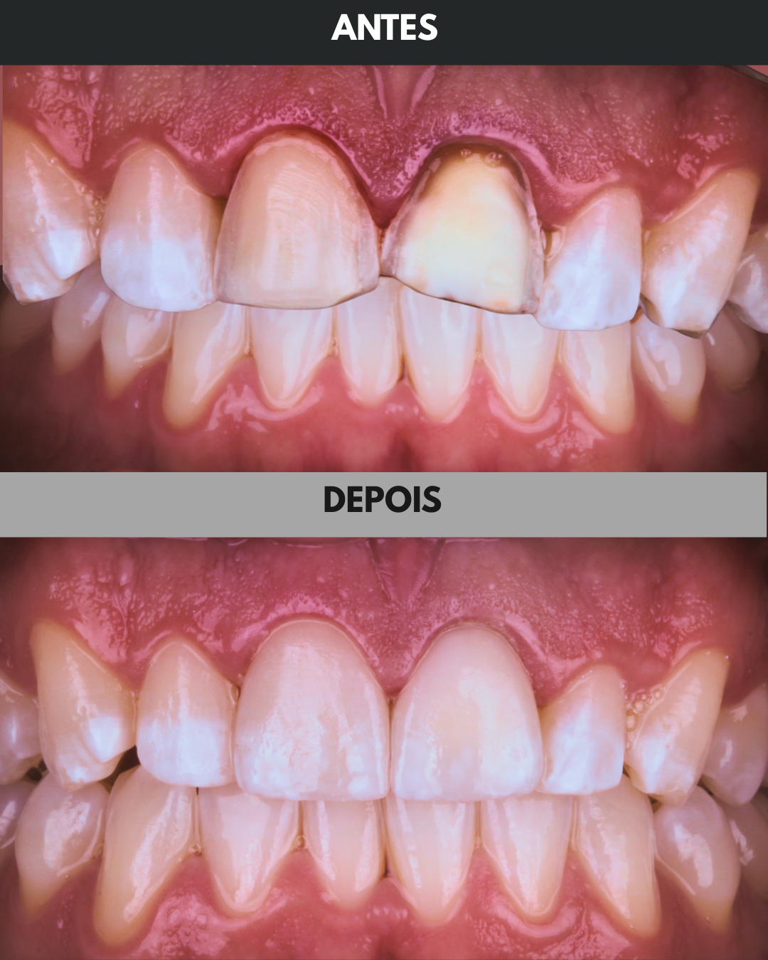 Antes e Depois - 02